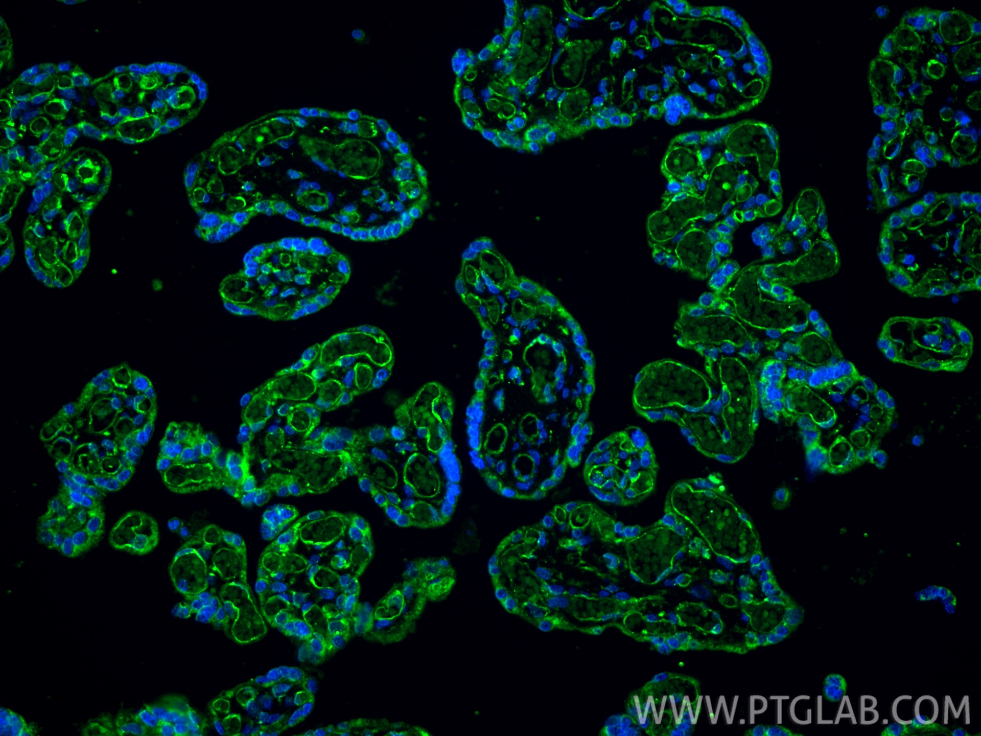 Immunofluorescence (IF) / fluorescent staining of human placenta tissue using VEGFR2/CD309 Recombinant monoclonal antibody (83049-4-RR)