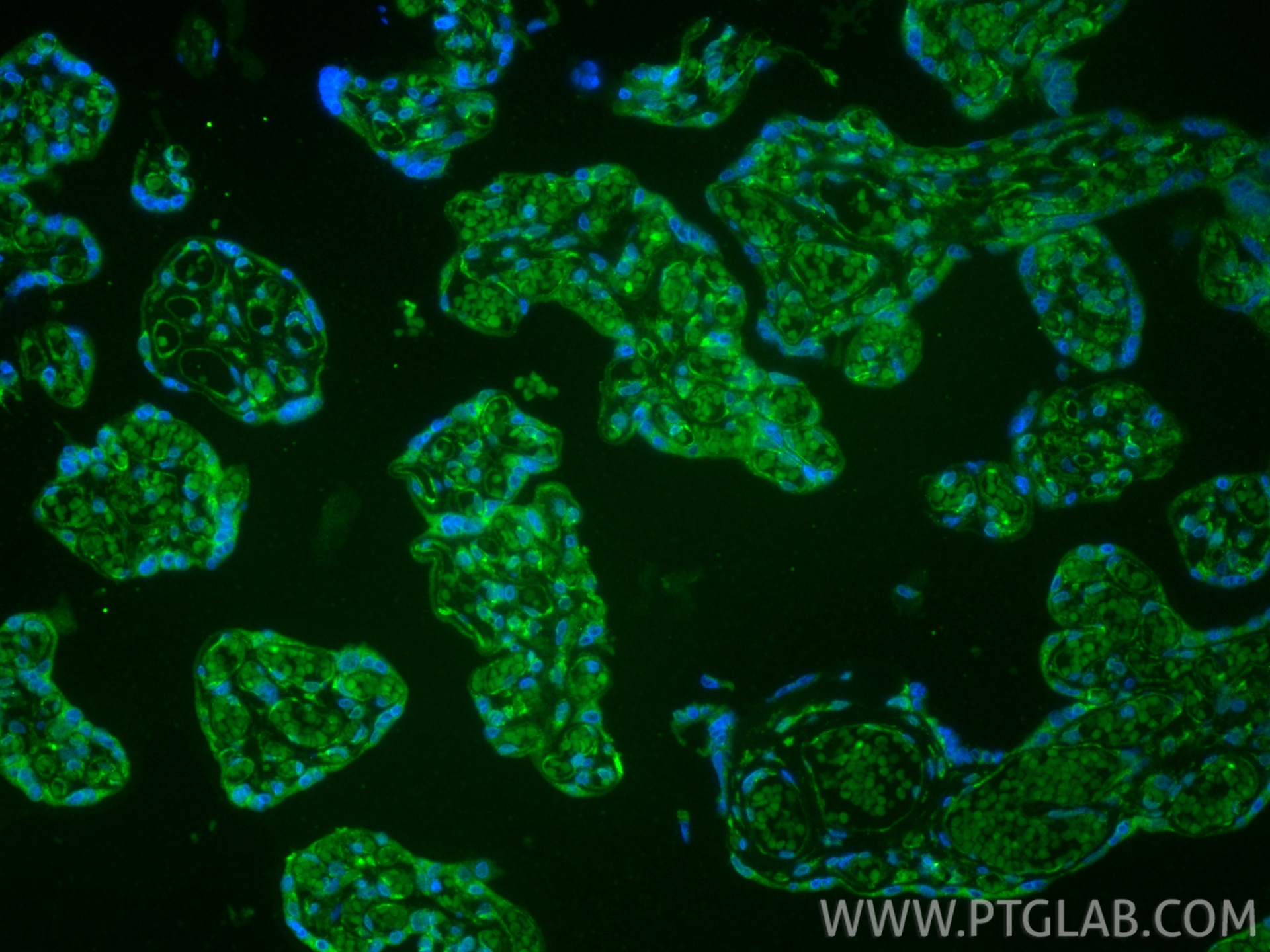Immunofluorescence (IF) / fluorescent staining of human placenta tissue using CoraLite® Plus 488-conjugated VEGFR2/CD309 Recombi (CL488-83049-4)