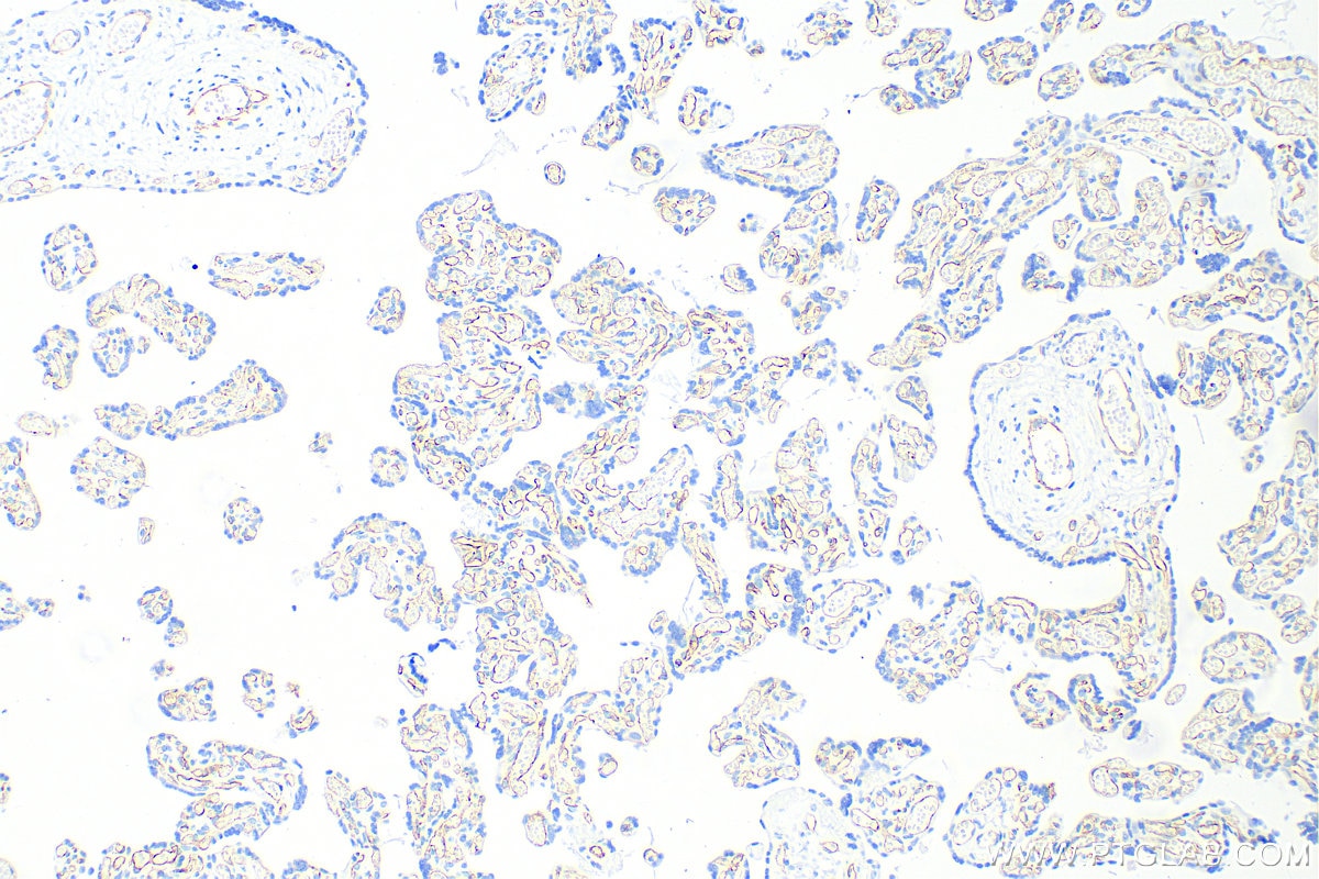 Immunohistochemistry (IHC) staining of human placenta tissue using VEGF Receptor 2 Recombinant antibody (83049-4-RR)