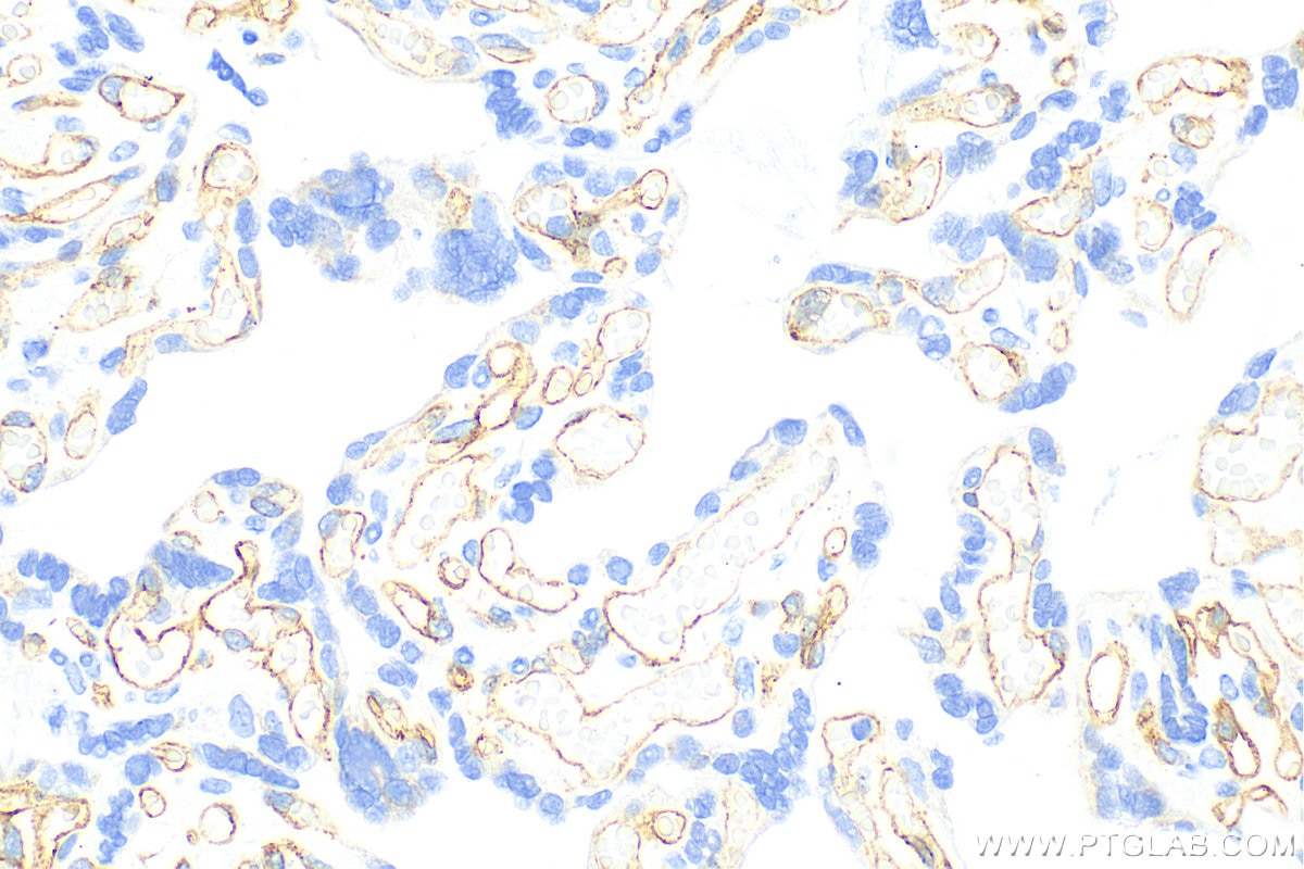 Immunohistochemistry (IHC) staining of human placenta tissue using VEGF Receptor 2 Recombinant antibody (83049-4-RR)