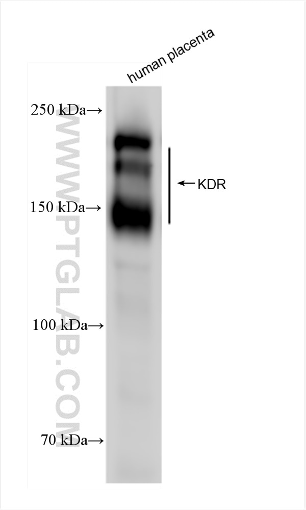 Western Blot (WB) analysis of human placenta tissue using VEGF Receptor 2 Recombinant antibody (83049-4-RR)