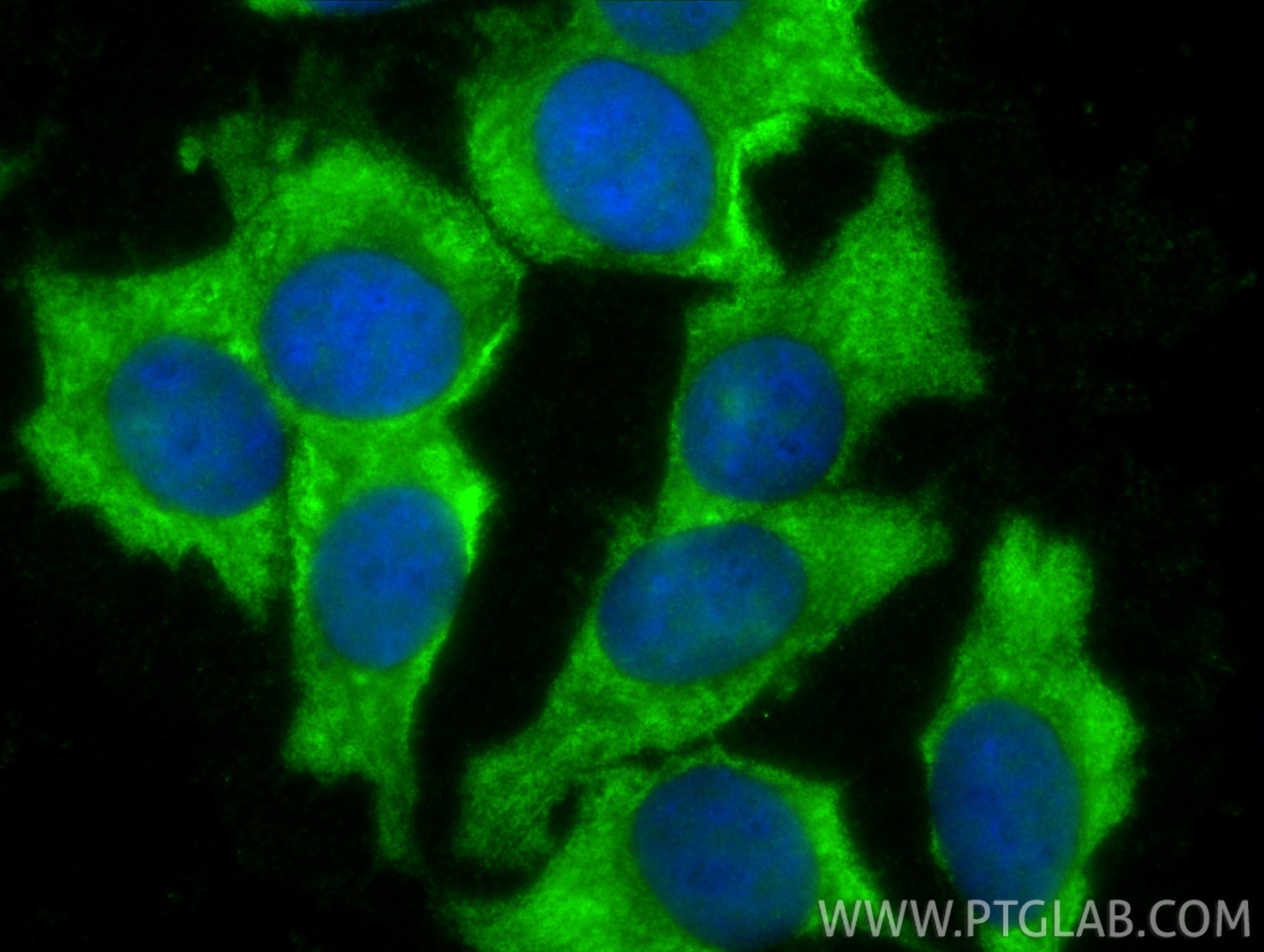 Immunofluorescence (IF) / fluorescent staining of MCF-7 cells using VEGFA Polyclonal antibody (19003-1-AP)