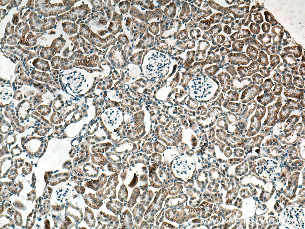 Immunohistochemistry (IHC) staining of mouse kidney tissue using VEGFA Polyclonal antibody (19003-1-AP)