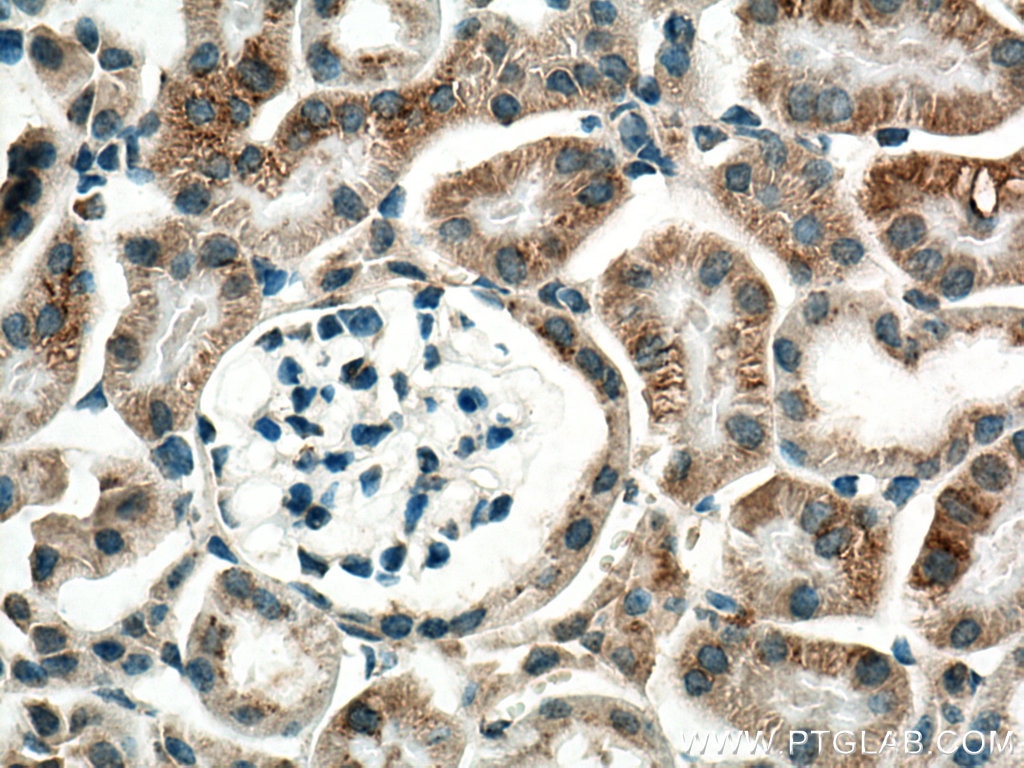 Immunohistochemistry (IHC) staining of mouse kidney tissue using VEGFA Polyclonal antibody (19003-1-AP)