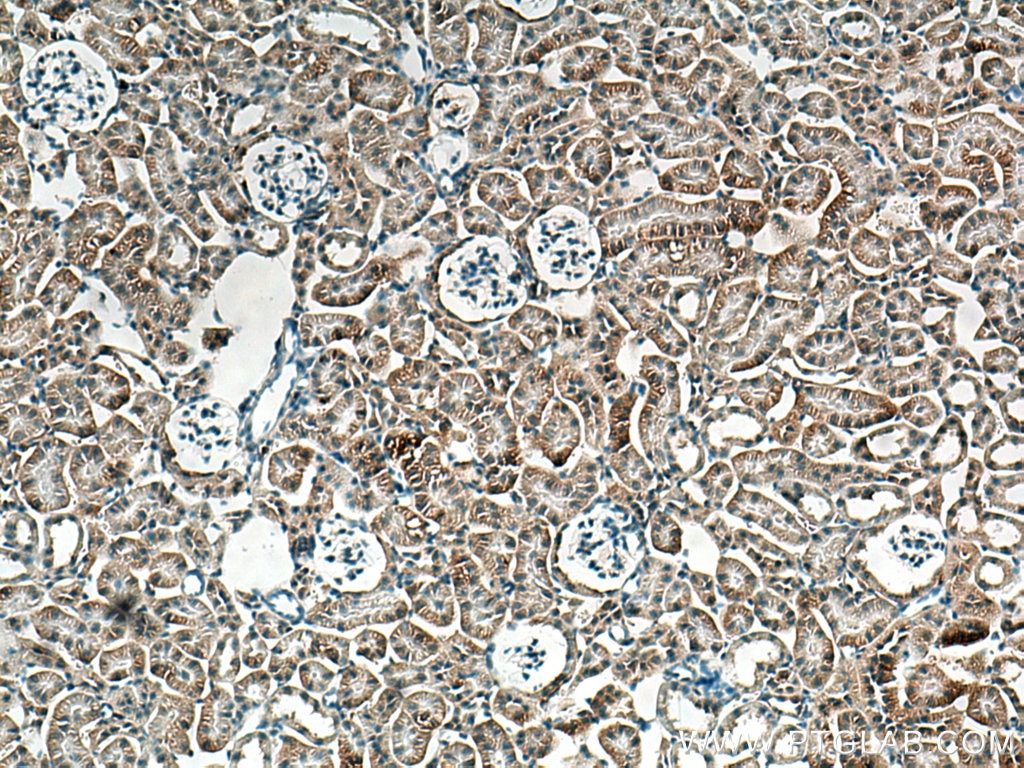 Immunohistochemistry (IHC) staining of mouse kidney tissue using VEGFA Polyclonal antibody (19003-1-AP)