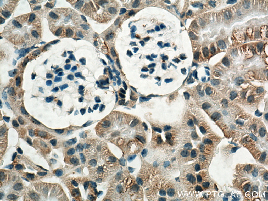 Immunohistochemistry (IHC) staining of mouse kidney tissue using VEGFA Polyclonal antibody (19003-1-AP)