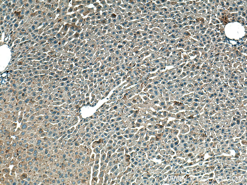 Immunohistochemistry (IHC) staining of mouse liver tissue using VEGFA Polyclonal antibody (19003-1-AP)