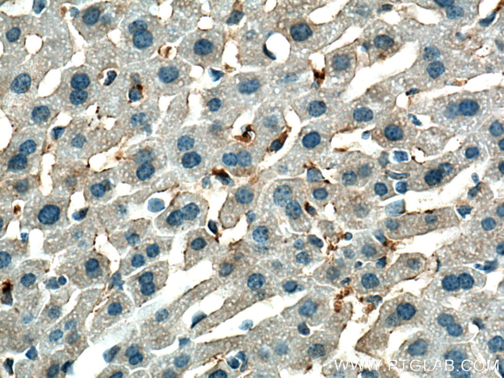 Immunohistochemistry (IHC) staining of mouse liver tissue using VEGFA Polyclonal antibody (19003-1-AP)