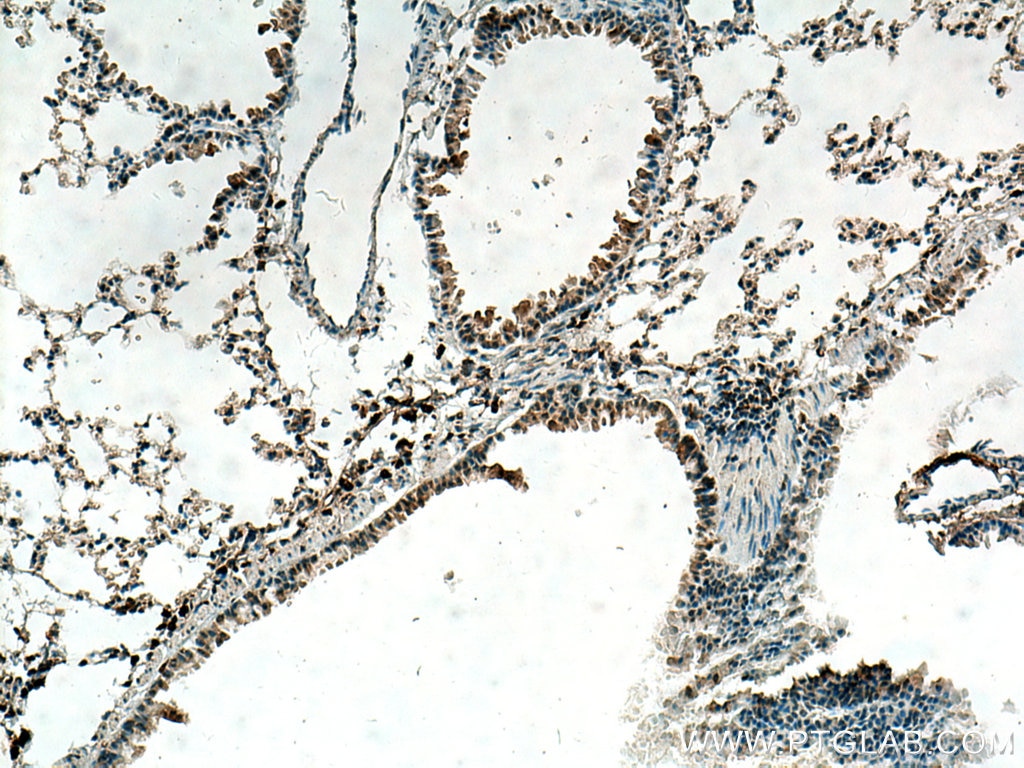 IHC staining of mouse lung using 19003-1-AP