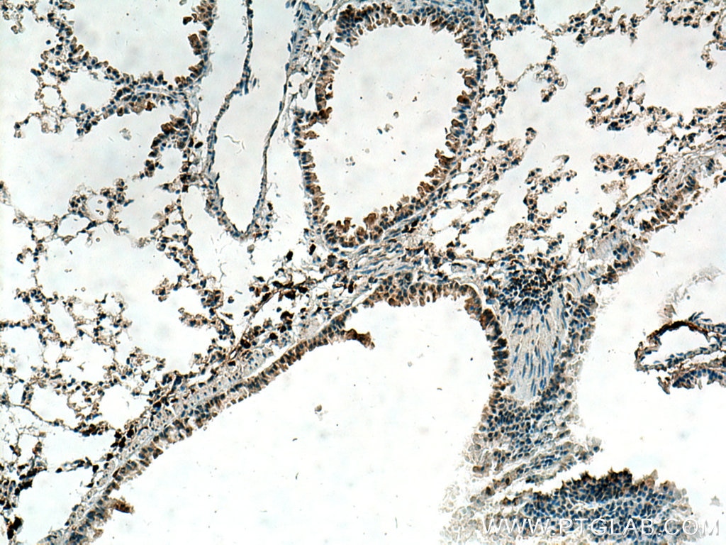 Immunohistochemistry (IHC) staining of mouse lung tissue using VEGFA Polyclonal antibody (19003-1-AP)