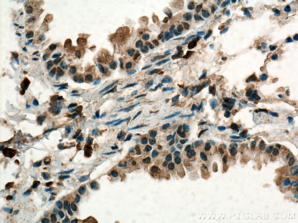 Immunohistochemistry (IHC) staining of mouse lung tissue using VEGFA Polyclonal antibody (19003-1-AP)