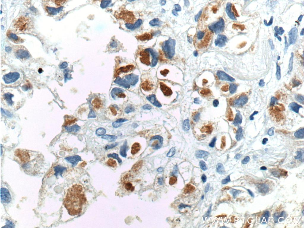 VEGFA Polyclonal antibody