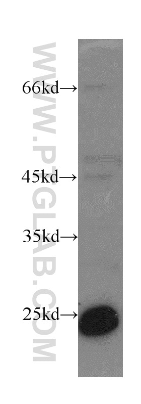 WB analysis of MCF-7 using 19003-1-AP