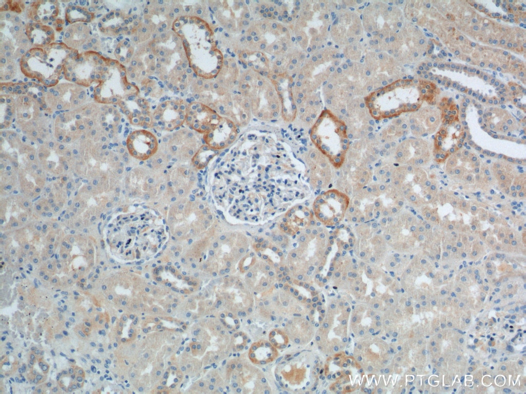 Immunohistochemistry (IHC) staining of human kidney tissue using VEGFA Polyclonal antibody (26381-1-AP)