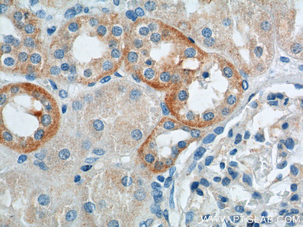 Immunohistochemistry (IHC) staining of human kidney tissue using VEGFA Polyclonal antibody (26381-1-AP)