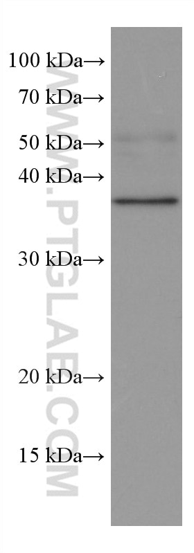 WB analysis of HUVEC using 66828-1-Ig