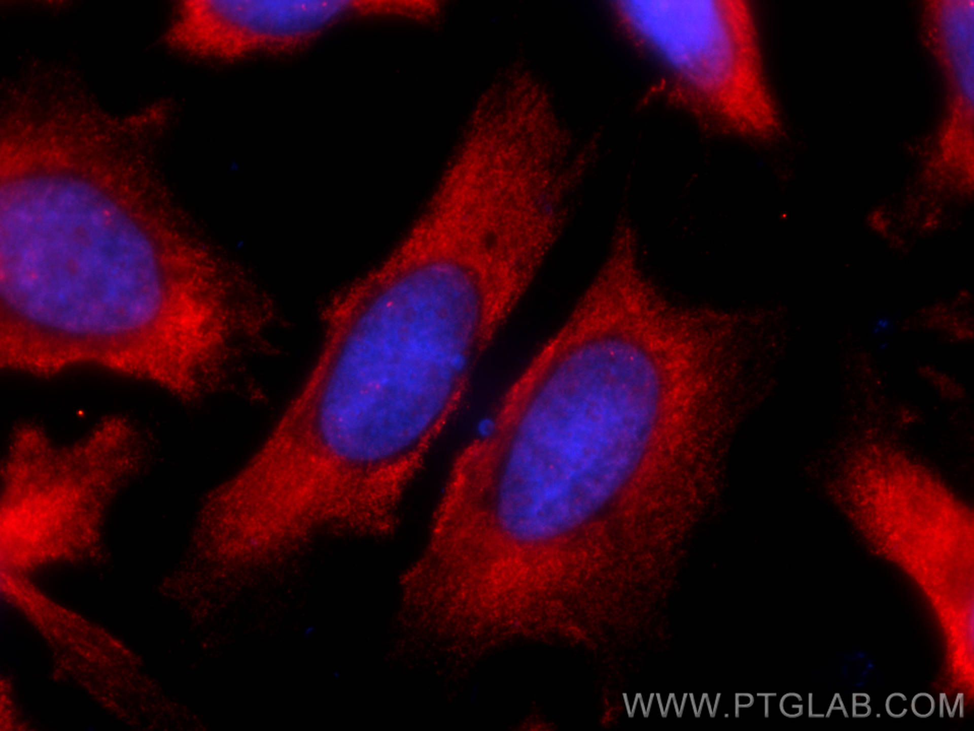 IF Staining of HeLa using CL594-66828