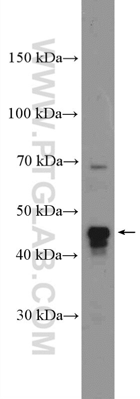 VEGFC Polyclonal antibody