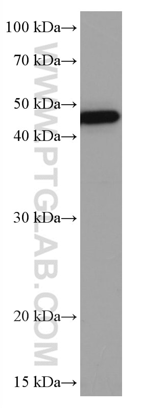 WB analysis of T-47D using 67116-1-Ig