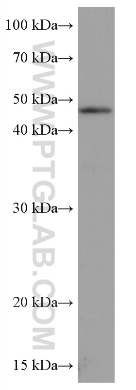 Western Blot (WB) analysis of LNCaP cells using VEGFC Monoclonal antibody (67116-1-Ig)