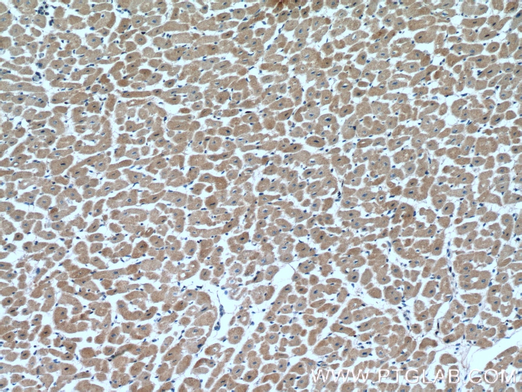 Immunohistochemistry (IHC) staining of human heart tissue using VEGFD Polyclonal antibody (26915-1-AP)