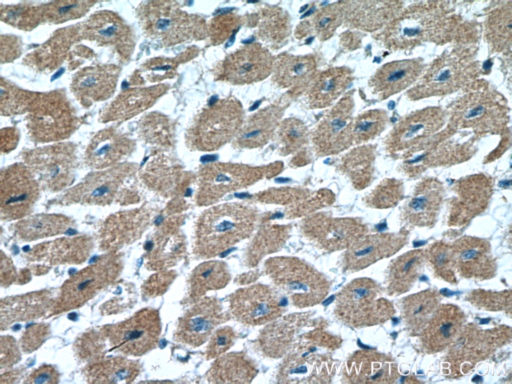 Immunohistochemistry (IHC) staining of human heart tissue using VEGFD Polyclonal antibody (26915-1-AP)