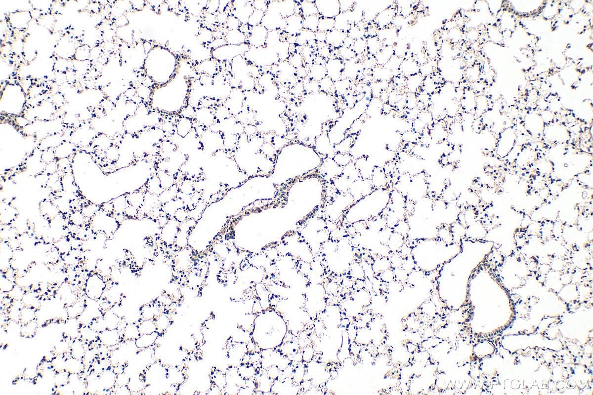 IHC staining of mouse lung using 30323-1-AP Immunohistochemistry (IHC) staining of mouse lung tissue using VEGFD Polyclonal antibody (30323-1-AP)
