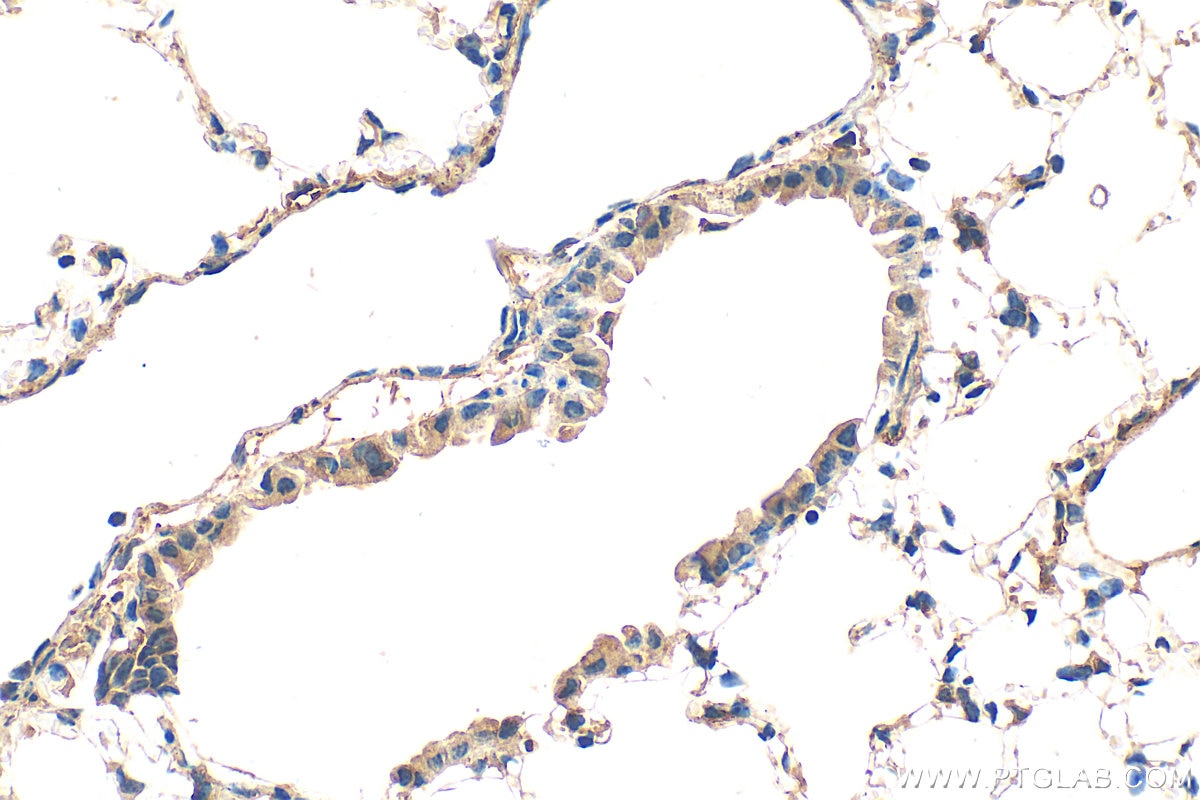 IHC staining of mouse lung using 30323-1-AP Immunohistochemistry (IHC) staining of mouse lung tissue using VEGFD Polyclonal antibody (30323-1-AP)
