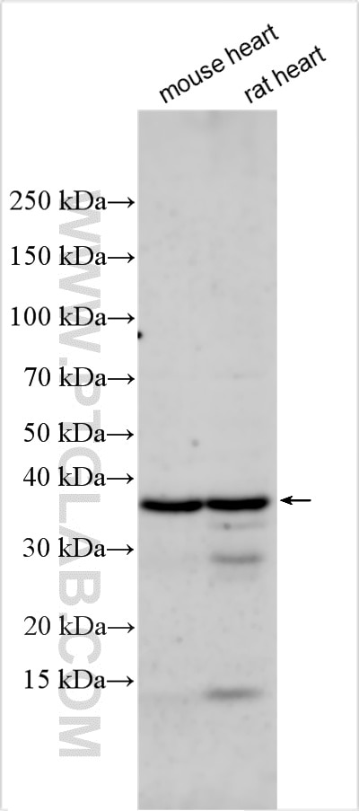 WB analysis using 30323-1-AP Western Blot (WB) analysis of various lysates using VEGFD Polyclonal antibody (30323-1-AP)