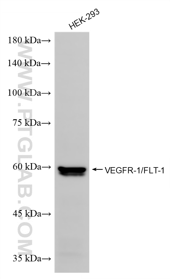 WB analysis of HEK-293 using 85844-2-RR (same clone as 85844-2-PBS) Western Blot (WB) analysis of HEK-293 cells using VEGFR-1/FLT-1 Recombinant monoclonal antibody (85844-2-RR)