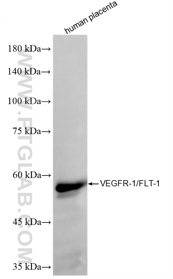 WB analysis of human placenta using 85844-2-RR (same clone as 85844-2-PBS) Western Blot (WB) analysis of human placenta tissue using VEGFR-1/FLT-1 Recombinant monoclonal antibody (85844-2-RR)