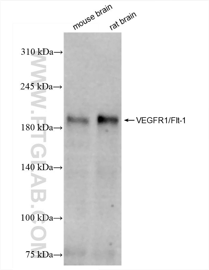 Western Blot (WB) analysis of various lysates using VEGFR1/Flt-1 Recombinant antibody (85761-4-RR)