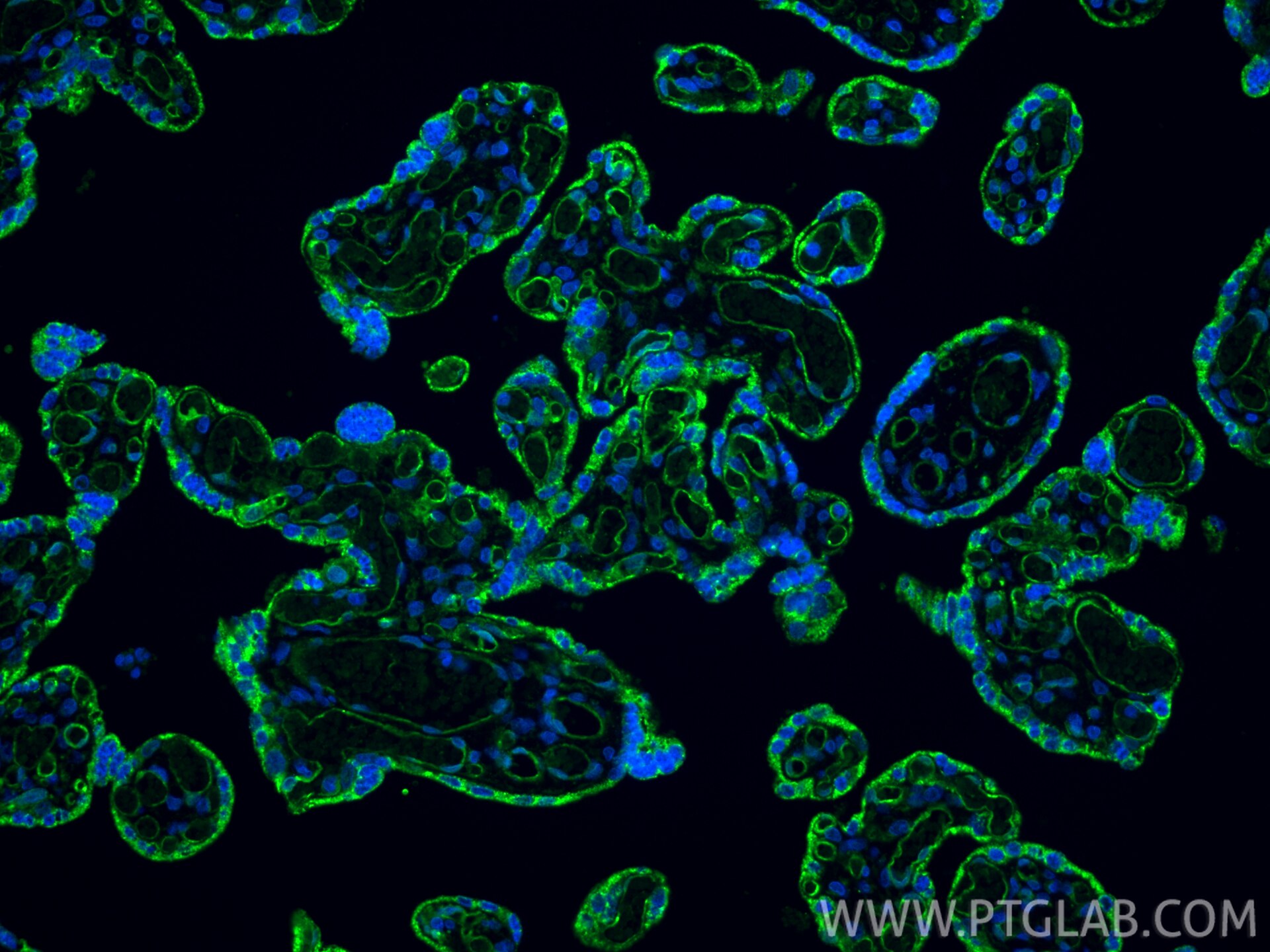 Immunofluorescent analysis of (4% PFA) fixed paraffin-embedded human placenta tissue using VEGFR2/KDR antibody (26415-1-AP) at dilution of 1:200 and CoraLite®488-Conjugated Goat Anti-Rabbit IgG(H+L) (SA00013-2). Heat mediated antigen retrieval with Tris-EDTA buffer (pH 9.0). Immunofluorescence (IF) / fluorescent staining of human placenta tissue using VEGFR2/KDR Polyclonal antibody (26415-1-AP)