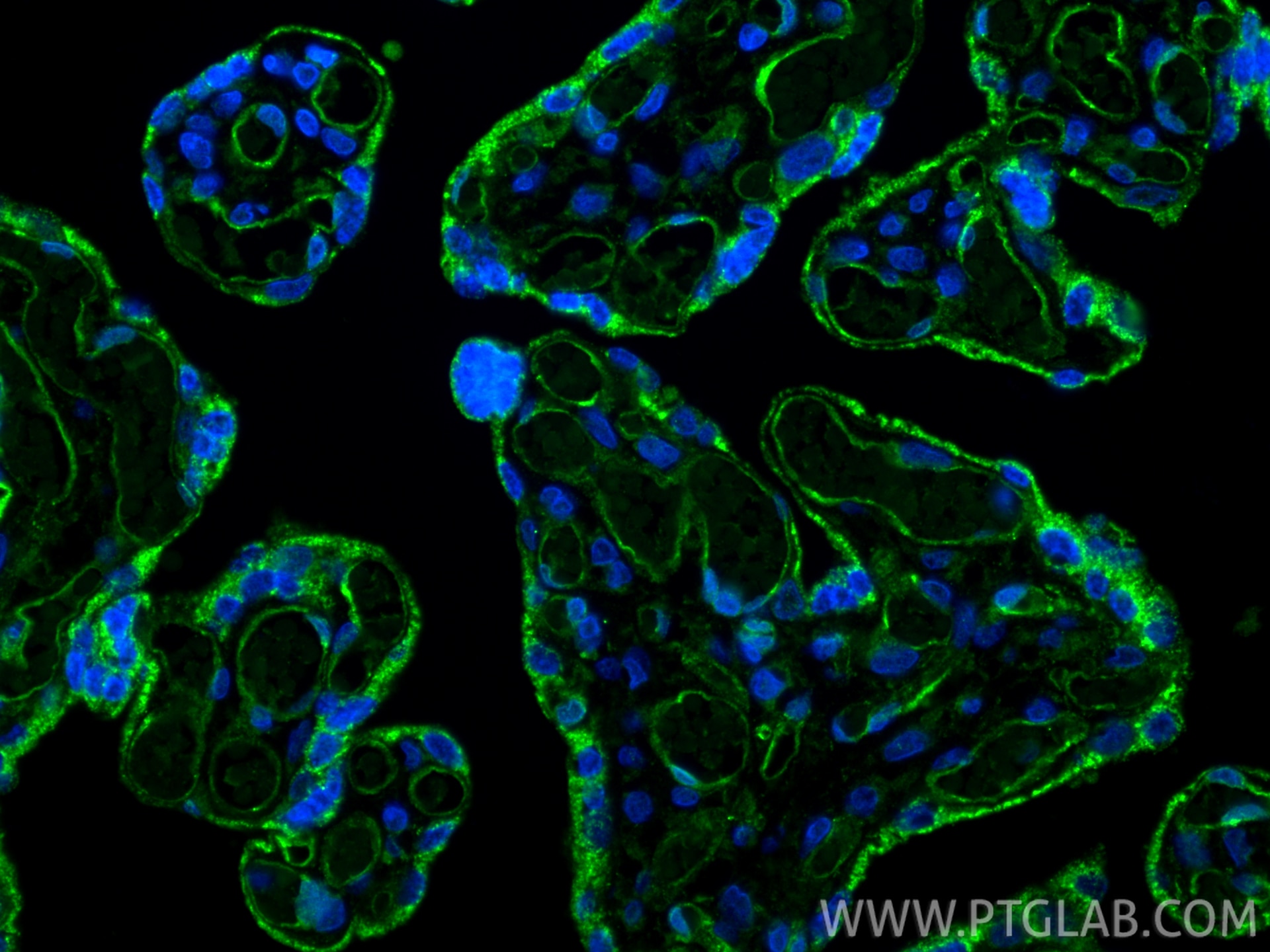 Immunofluorescent analysis of (4% PFA) fixed paraffin-embedded human placenta tissue using VEGFR2/KDR antibody (26415-1-AP) at dilution of 1:200 and CoraLite®488-Conjugated Goat Anti-Rabbit IgG(H+L) (SA00013-2). Heat mediated antigen retrieval with Tris-EDTA buffer (pH 9.0). Immunofluorescence (IF) / fluorescent staining of human placenta tissue using VEGFR2/KDR Polyclonal antibody (26415-1-AP)