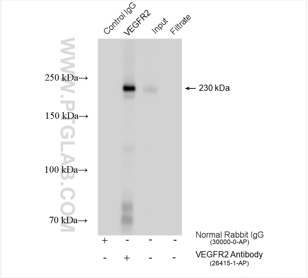 Immunoprecipitation (IP) experiment of human placenta tissue using VEGFR2 Polyclonal antibody (26415-1-AP)