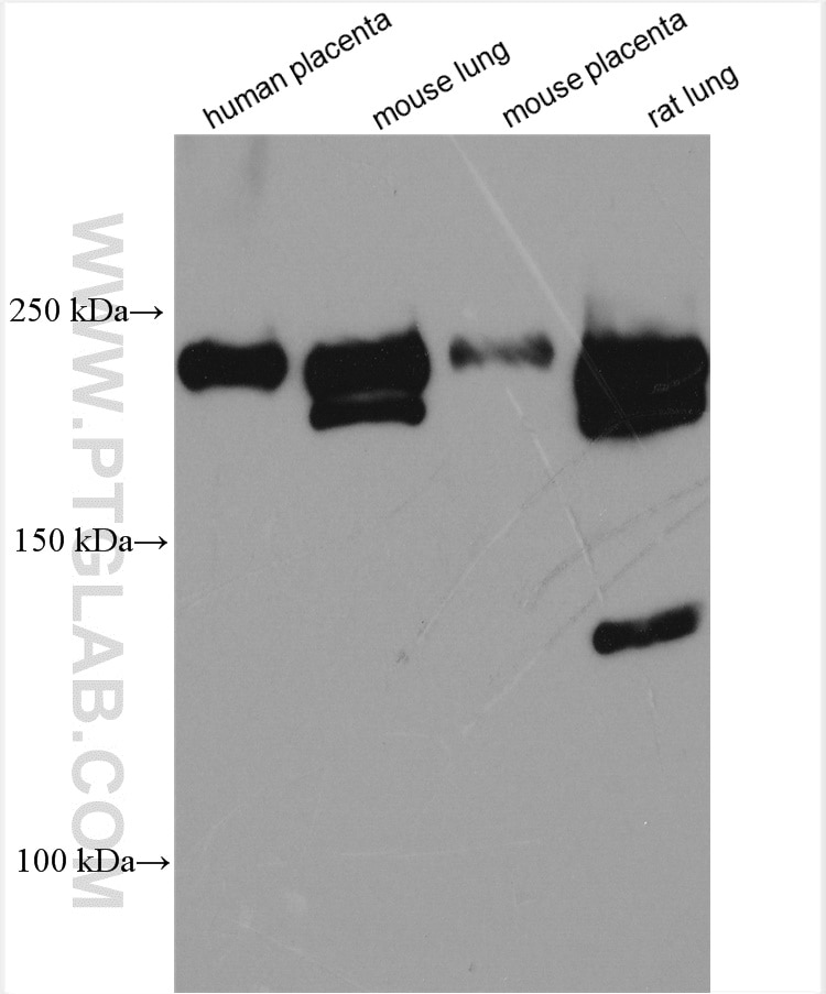 Western Blot (WB) analysis of various lysates using VEGFR2 Polyclonal antibody (26415-1-AP)