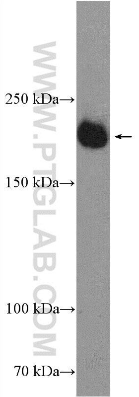 Western Blot (WB) analysis of human placenta tissue using VEGFR2 Polyclonal antibody (26415-1-AP)