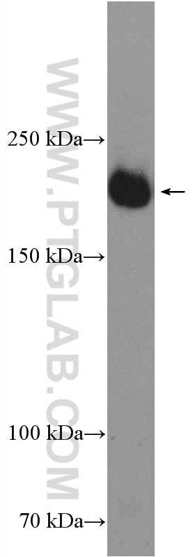 WB analysis of human placenta using 26415-1-AP