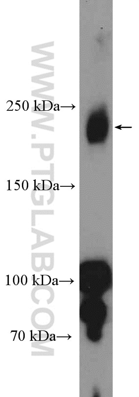 Western Blot (WB) analysis of mouse heart tissue using VEGFR2 Polyclonal antibody (26415-1-AP)