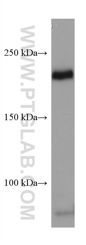 Western Blot (WB) analysis of human placenta tissue using VEGFR2 Monoclonal antibody (67407-1-Ig)