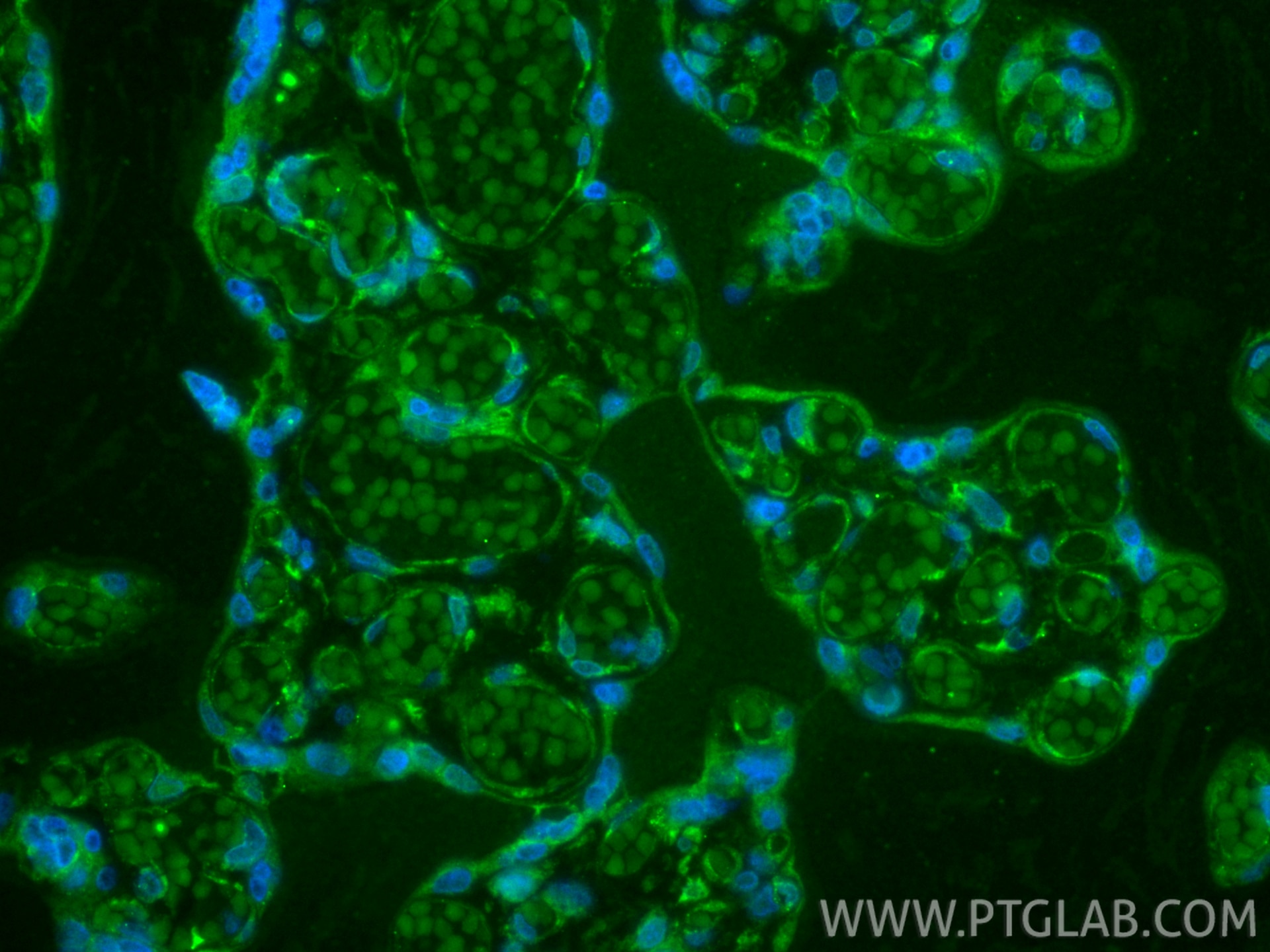 Immunofluorescence (IF) / fluorescent staining of human placenta tissue using CoraLite® Plus 488-conjugated VEGFR2/CD309 Recombi (CL488-83049-4)