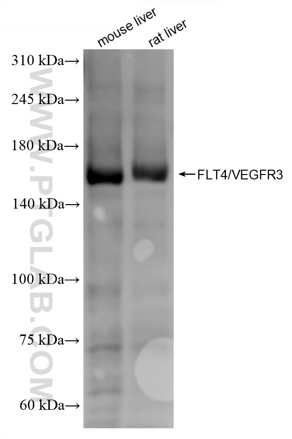 WB analysis using 87120-3-RR Western Blot (WB) analysis of various lysates using VEGFR3/FLT4 Recombinant monoclonal antibody (87120-3-RR)