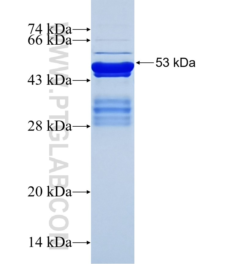 VENTX fusion protein Ag16009 SDS-PAGE
