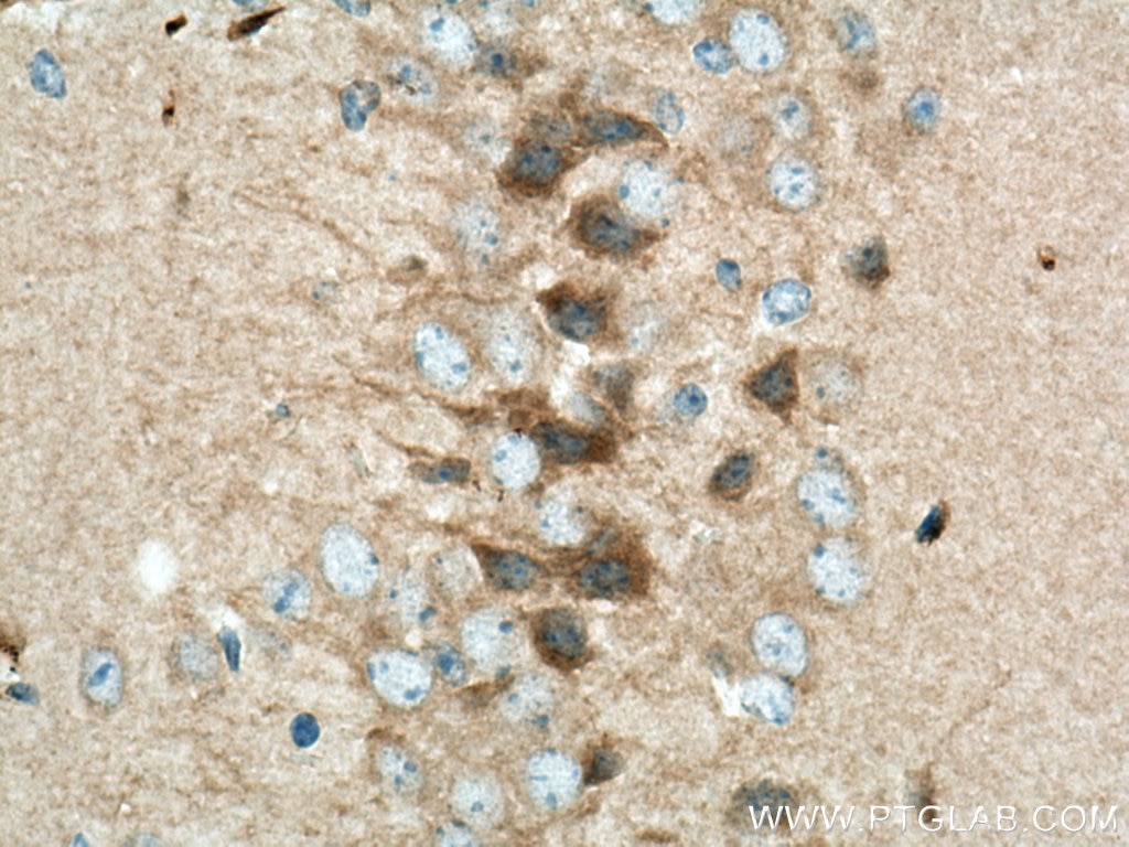 Immunohistochemistry (IHC) staining of mouse brain tissue using VEZT Polyclonal antibody (17684-1-AP)