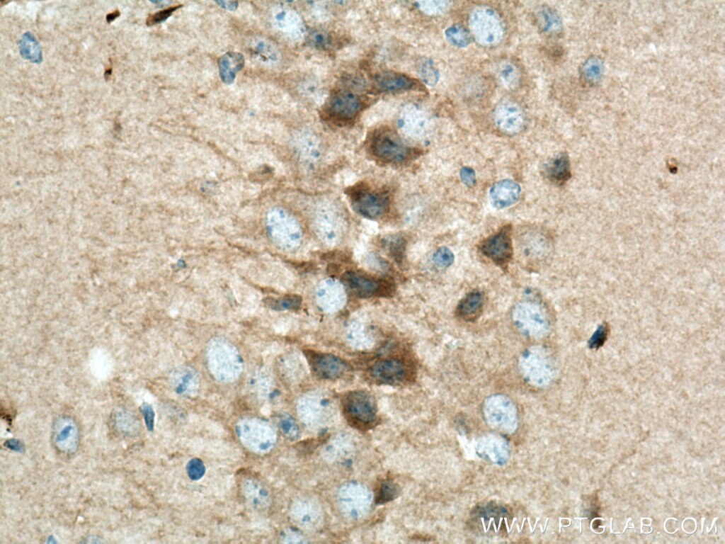 Immunohistochemistry (IHC) staining of mouse brain tissue using VEZT Polyclonal antibody (17684-1-AP)