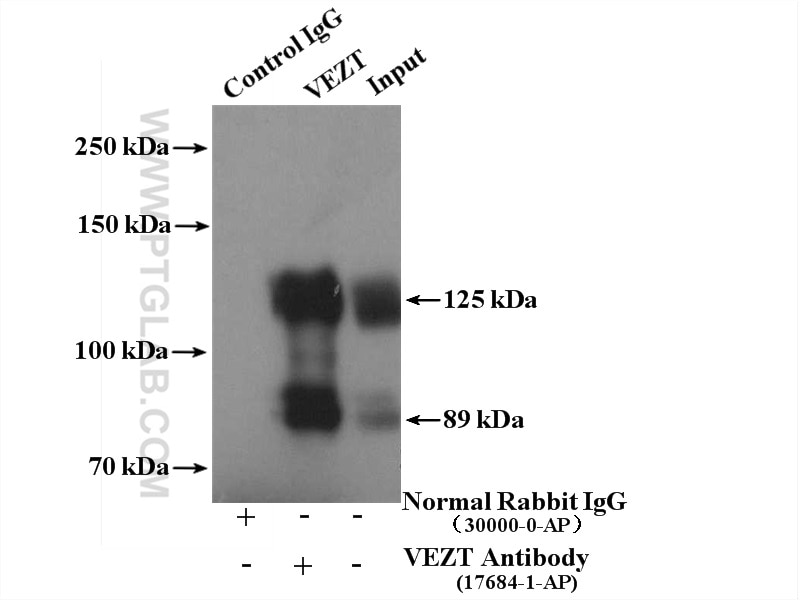 Immunoprecipitation (IP) experiment of mouse brain tissue using VEZT Polyclonal antibody (17684-1-AP)
