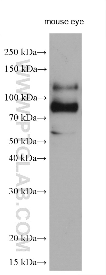 Western Blot (WB) analysis of various lysates using VEZT Polyclonal antibody (17684-1-AP)