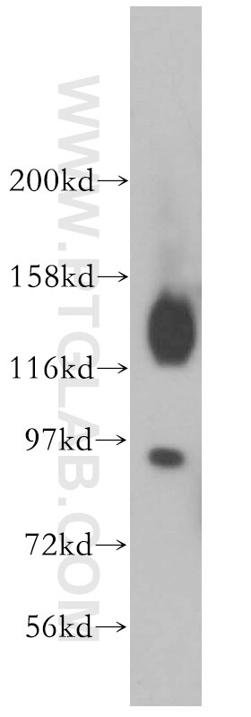 Western Blot (WB) analysis of human brain tissue using VEZT Polyclonal antibody (17684-1-AP)