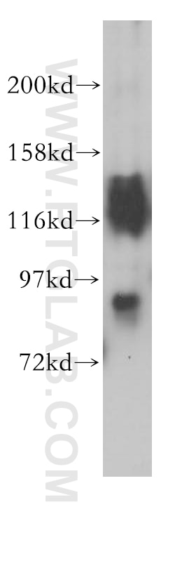 Western Blot (WB) analysis of mouse brain tissue using VEZT Polyclonal antibody (17684-1-AP)