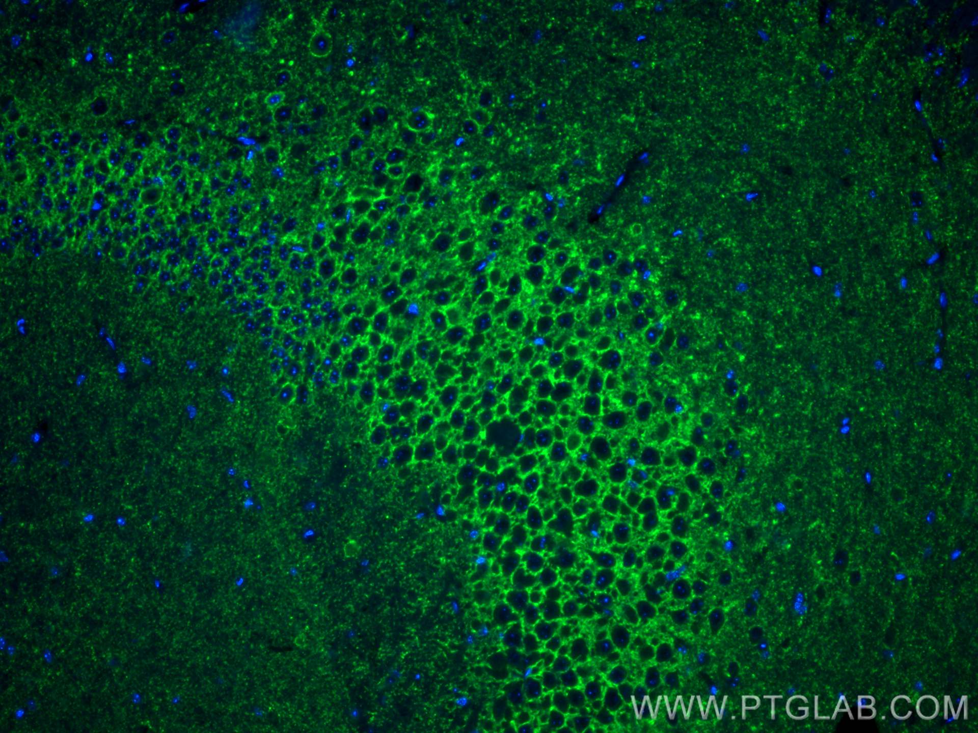 Immunofluorescence (IF) / fluorescent staining of mouse brain tissue using CoraLite® Plus 488-conjugated VGAT Polyclonal anti (CL488-14471)